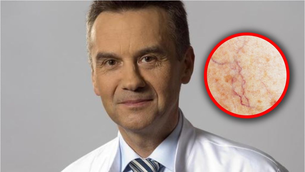 Te choroby kosztują nas 56 miliardów rocznie