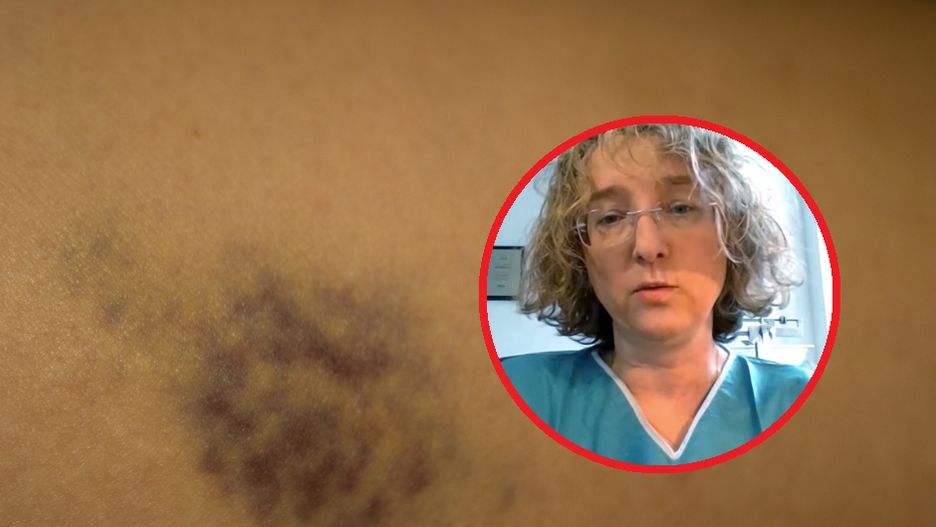 Jak rozpoznać objawy dziecięcego nowotworu?