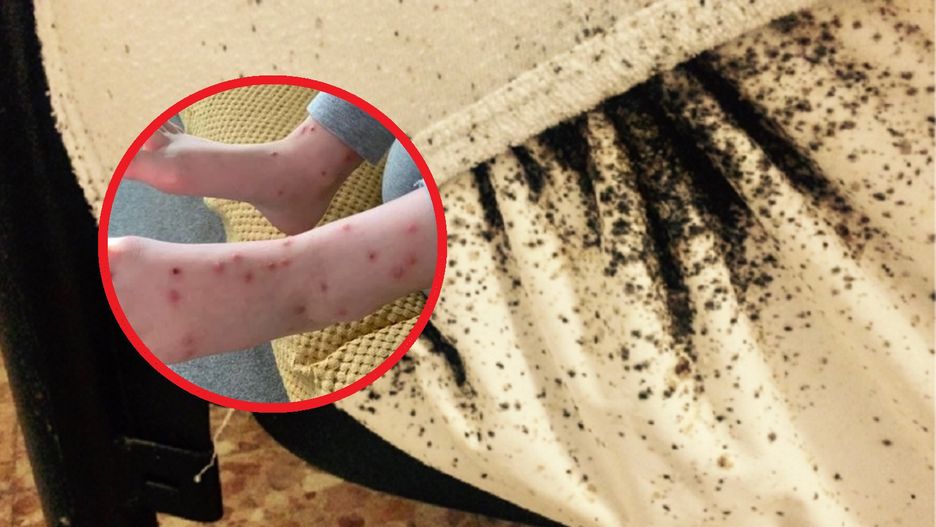Zauważyła ślady na nogach córki. Zamarła, gdy sprawdziła łóżka w hotelu