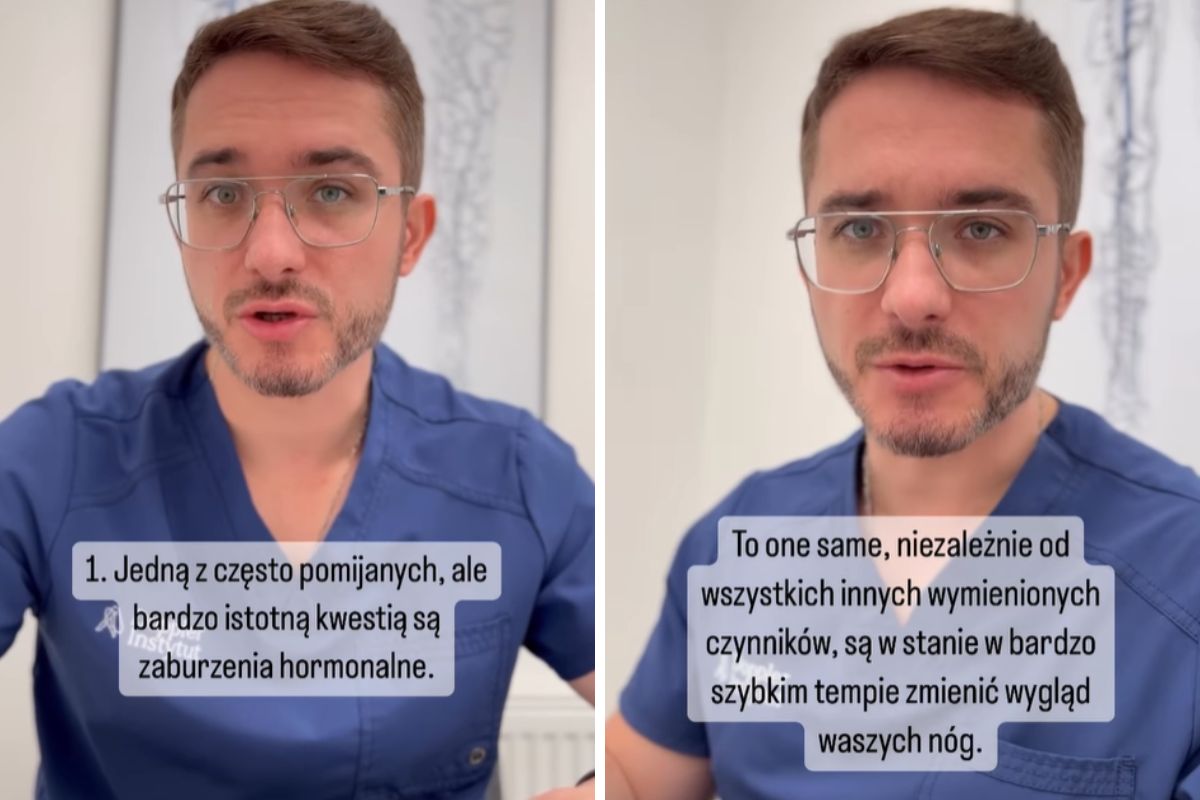 Zaburzenia hormonalne to jedna z przyczyn obecności cellulitu na skórze