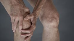 Objawy nowotworów, które do złudzenia przypominają chorobę reumatyczną 