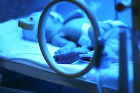 Noworodki przebywające na oddziałach intensywnej terapii mają większe szanse na wystąpienie problemów psychicznych w przyszłości