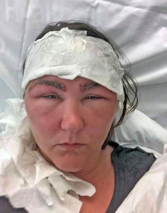 Nicole bardzo cierpiała