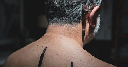 Na wrzody i miażdżycę. Wracają do łask, ale nie są dla każdego
