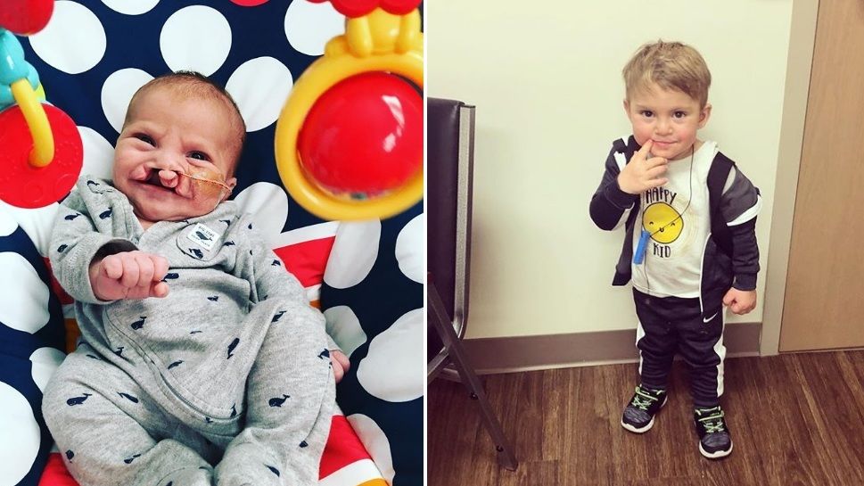 Lekarze sugerowali aborcję, dziś Brody nie różni się od rówieśników