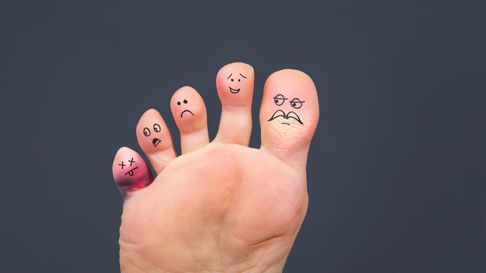 Podagra najczęściej atakuje staw palucha w stopie.