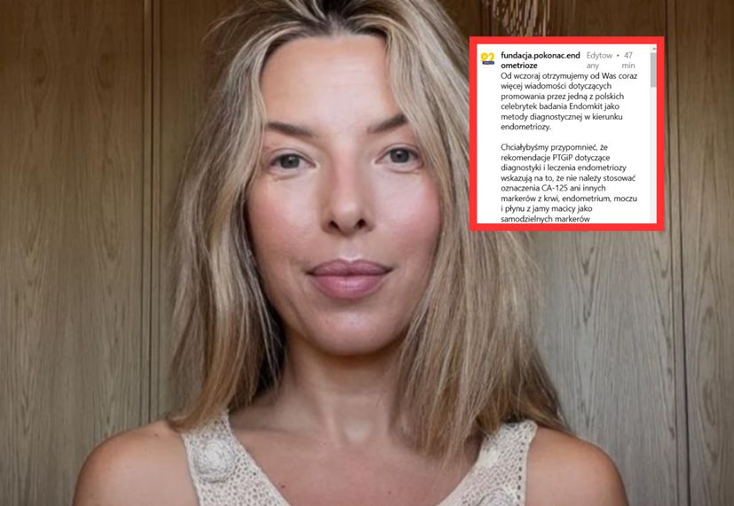 Lekarze przeciwko Chodakowskiej. "Chciwość celebrytów nie zna granic"