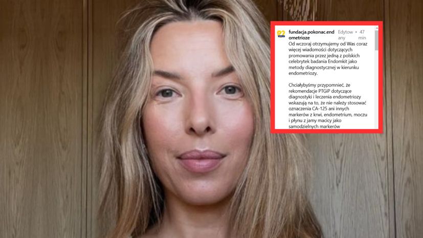 Lekarze przeciwko Chodakowskiej. "Chciwość celebrytów nie zna granic"