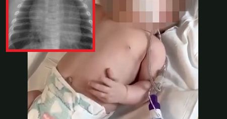 Lekarka pokazała zdjęcia. Takie spustoszenie spowodował wirus