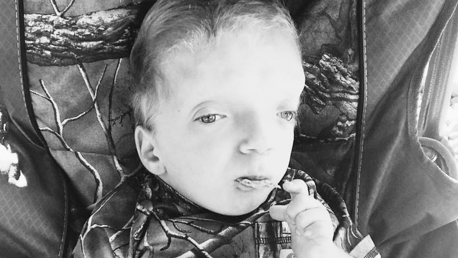 Chłopiec urodził się z niewykle rzadką chorobą. Dolegliwości nazwano jego imieniem
