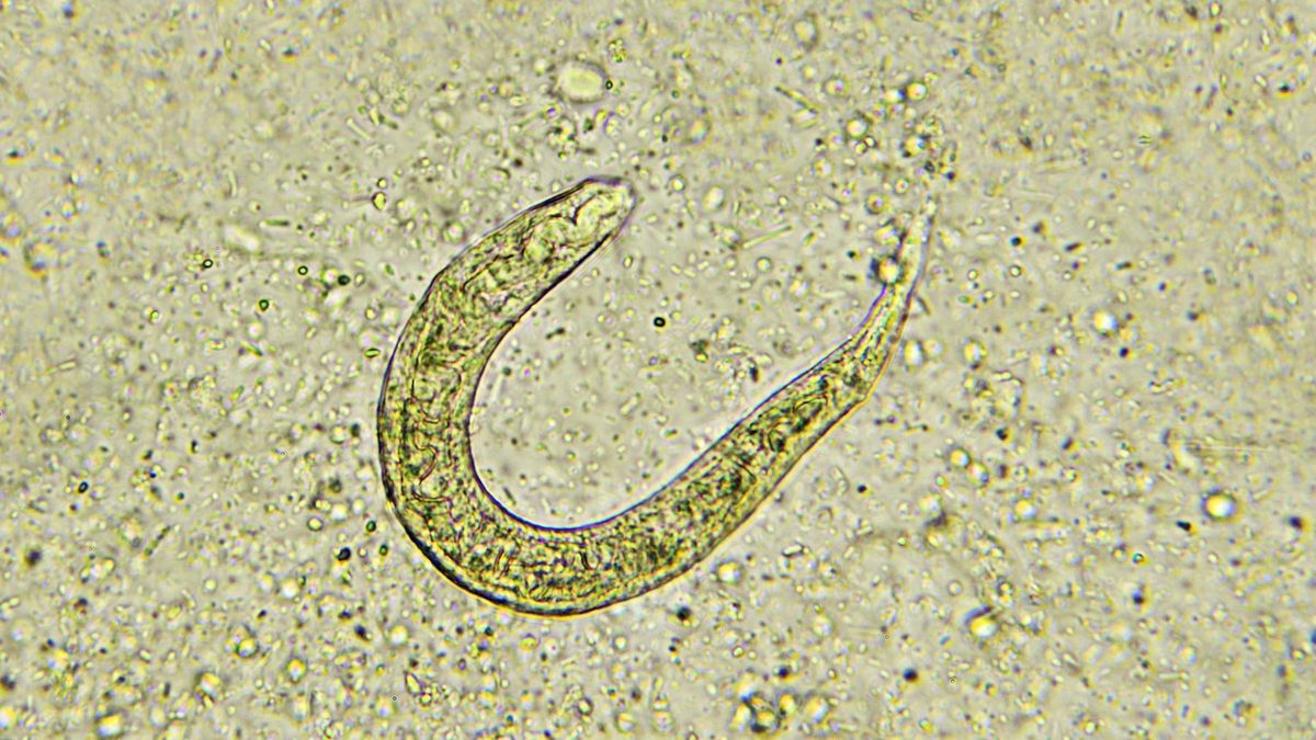 Jak skutecznie leczyć owsiki?