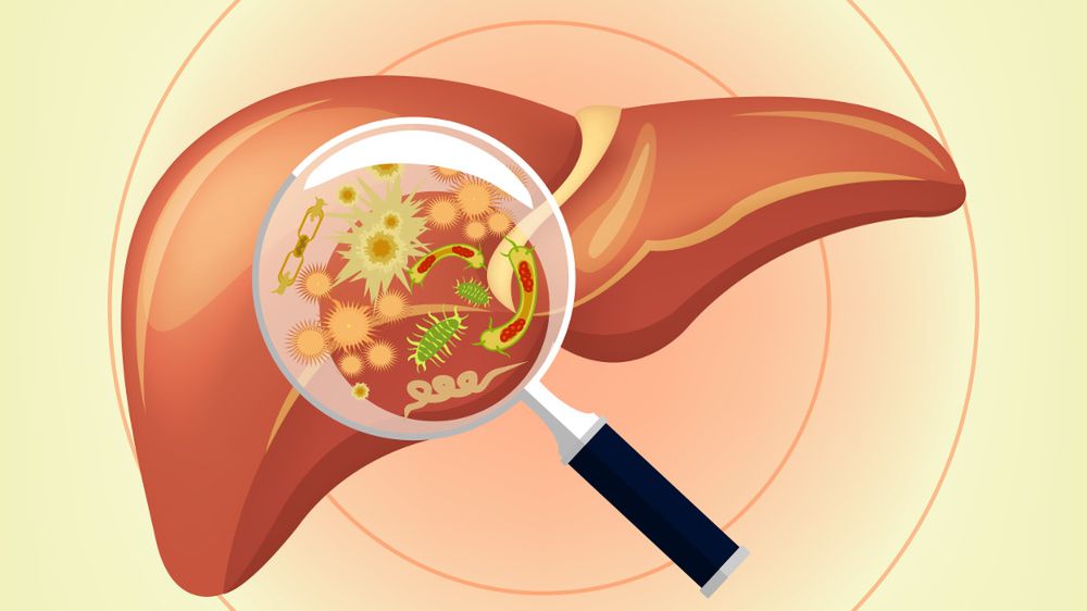 Wirus HCV jest odpowiedzialny za rozwój zapalenia wątroby typu C
