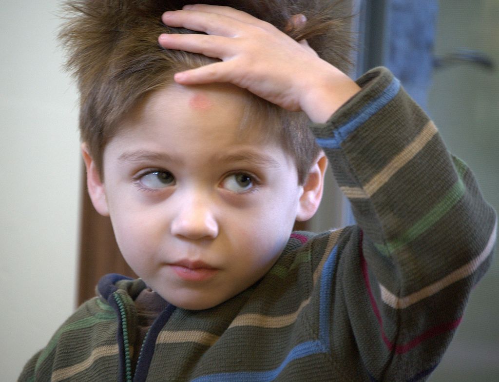 Urazy głowy – klasyfikacja, wczesne i późne następstwa, pierwsza pomoc