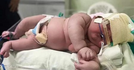 Wywołał sensację na porodówce. 27-latka urodziła gigantyczne dziecko