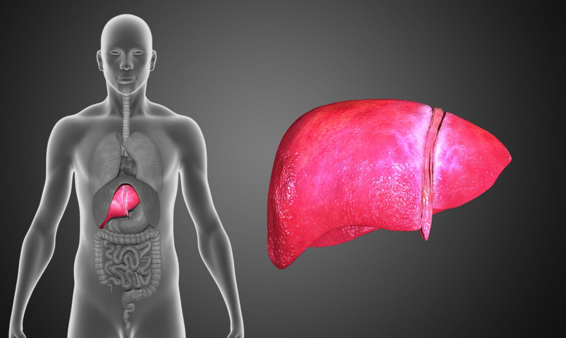 Niealkoholowa stłuszczeniowa choroba wątroby spowodowana jest nadmiernym gromadzeniem tłuszczu w tym organie