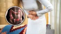 Choruje coraz więcej młodych osób. Onkolog wskazuje 5 czynników