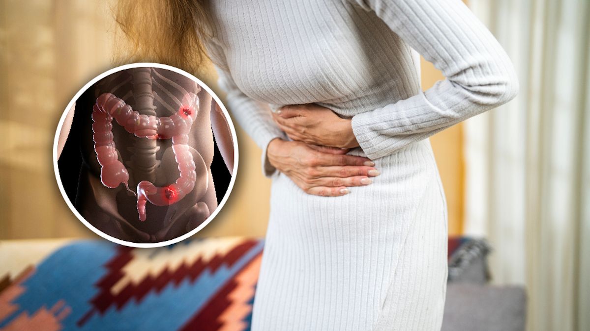 Gastrolog wskazuje 5 błędów. Podnoszą ryzyko raka jelita grubego