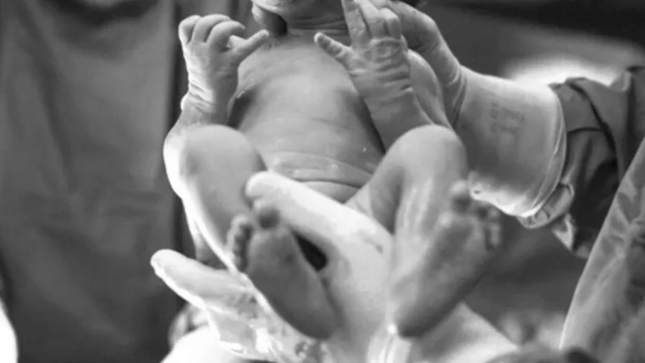 Podczas porodu urwali główkę dziecka. Lekarka próbowała zatuszować sprawę