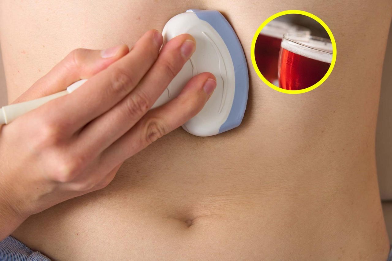 Hepatolog radzi, jak zadbać o wątrobę. Tych produktów unikaj