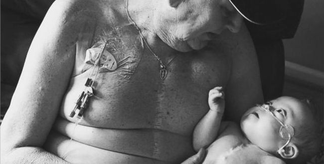 Zdjęcie dziadka i wnuczka po operacjach serc podbija internet