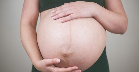 Domowe sposoby na rozjaśnienie rozstępów