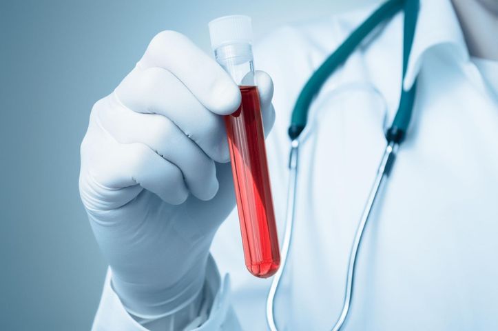 Anty-TPO oznacza się w badaniu krwi
