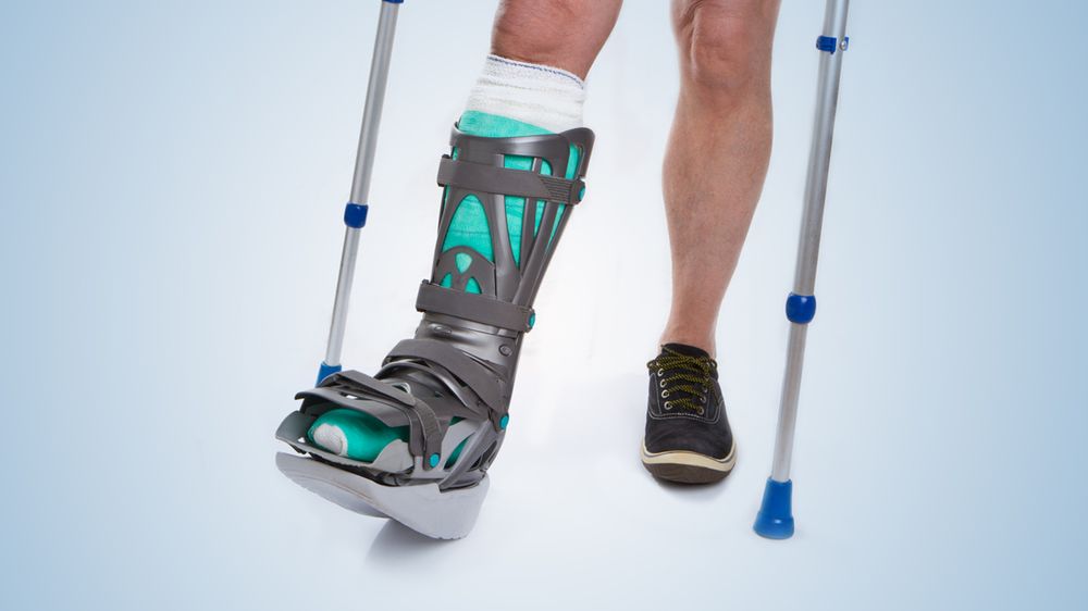 Orteza skutecznie zastępuje gips