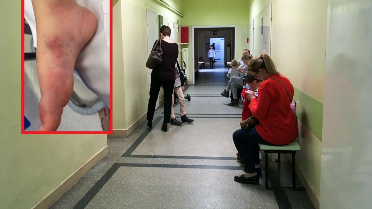 Widzisz te objawy u swojego dziecka? Biegnij do lekarza