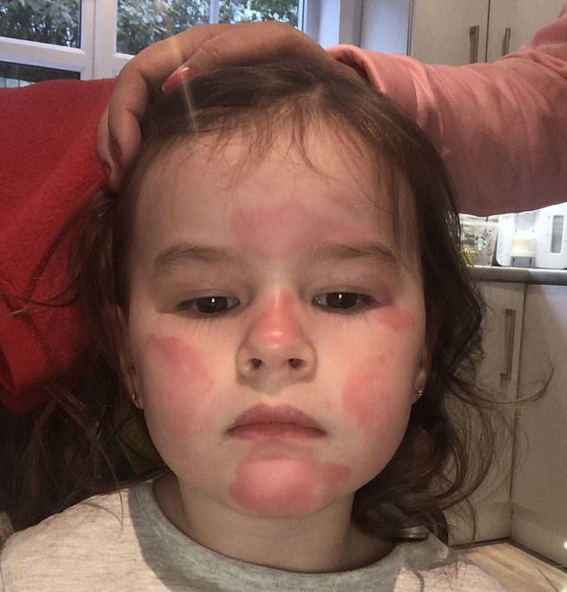 Po kilku sekundach pojawiły się czerwone plamy