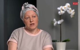 Łysiejące placki i wypadające brwi. Co dolega Marcie? (WIDEO)