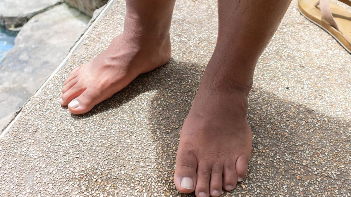 Eksperci wymieniają najczęstsze objawy raka skóry. Wskazują najbardziej podstępne miejsce