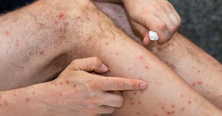 Widoczny objaw. Jelita mogą już być zajęte przez raka