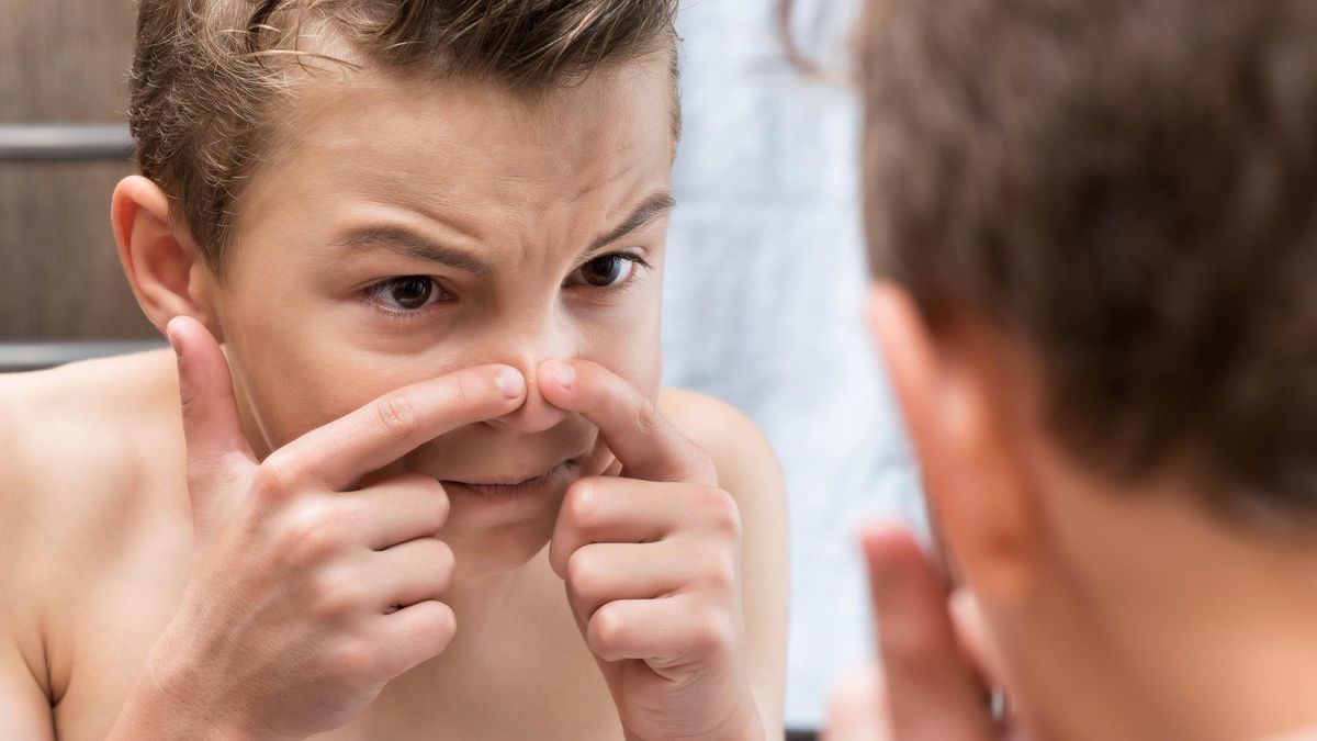 Każdy specjalista dermatolog odradza wyciskania pryszczy na własną rękę. Wszystko przez niebezpieczeństwo, jakie niesie ze sobą "trójkąt śmierci".