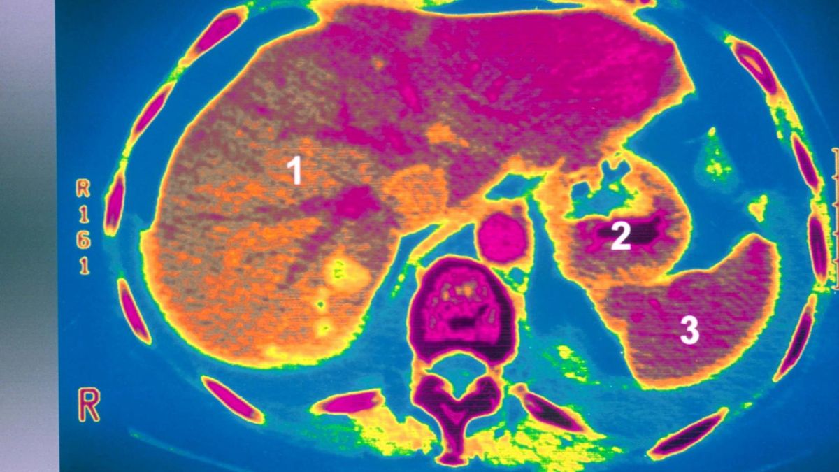 Koronawirus uszkadza wątrobę