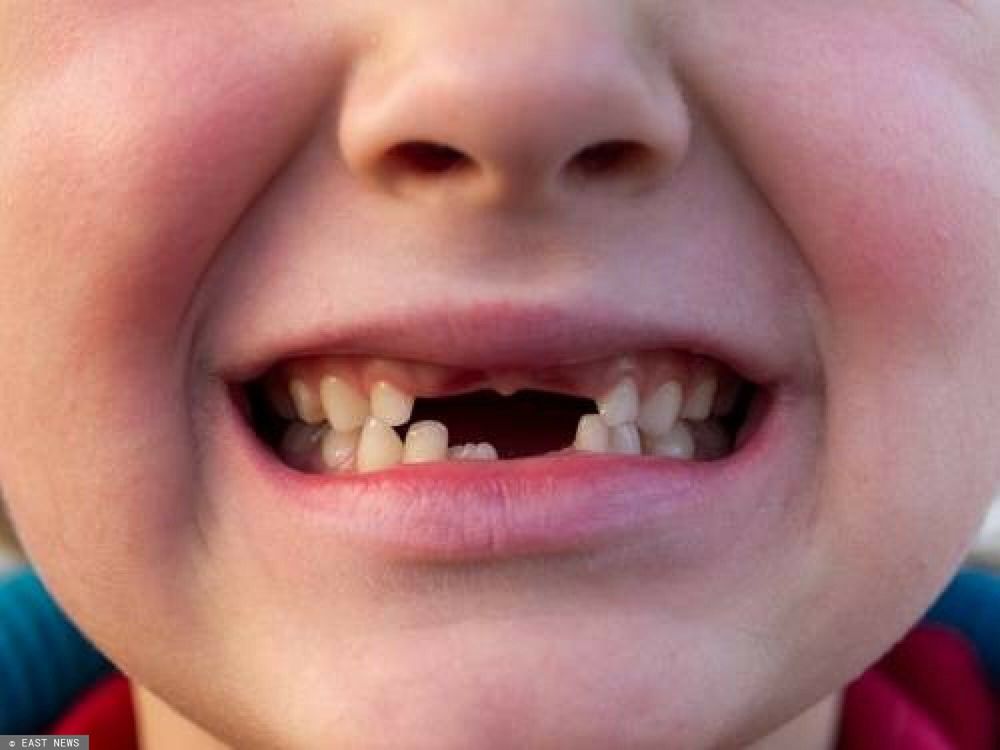 Komórki macierzyste obecne w zębach mlecznych mogą uratować w przyszłości życie dziecka