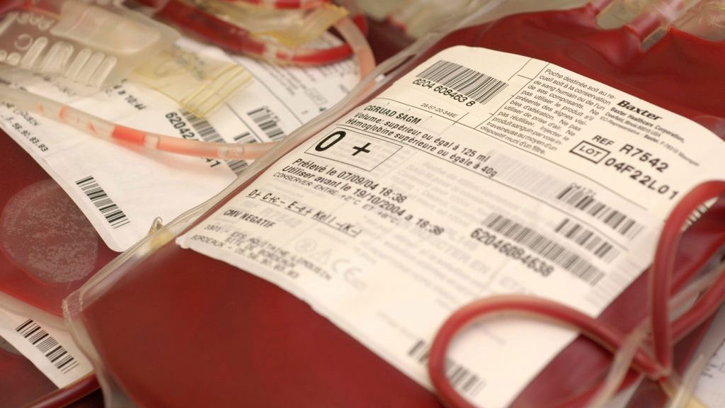 Grupa krwi może wpływać na ryzyko udaru mózgu w młodym wieku