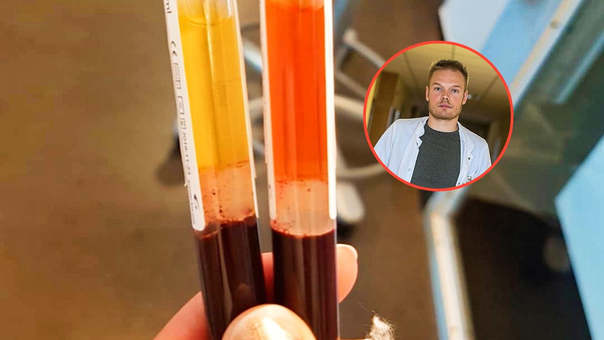 Próbka krwi, zdaniem naukowców, może być pomocna w profilaktyce raka jelita grubego