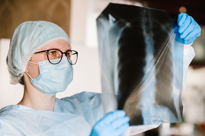 Tomografia płuc jest badaniem zalecanym nałogowym palaczom