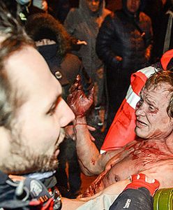 Ukraina: cztery osoby w stanie ciężkim po zamieszkach w Kijowie