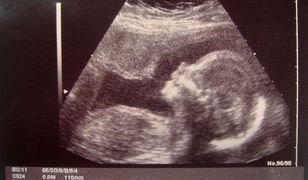 Rozstrzygną się losy ustawy zakazującej aborcji