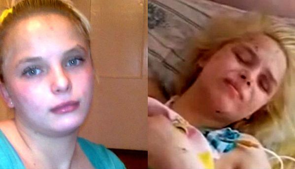 Zmarła 18-letnia Oksana - ofiara zbiorowego gwałtu i podpalenia