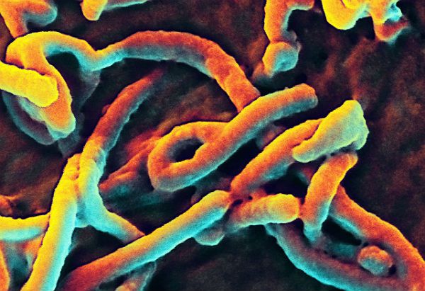 Pielęgniarka zarażona ebolą w stanie krytycznym