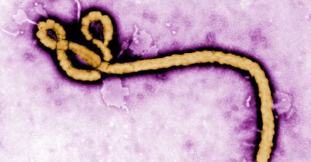 Ebola może dotrzeć do Gdańska. Czy służby są na to gotowe?
