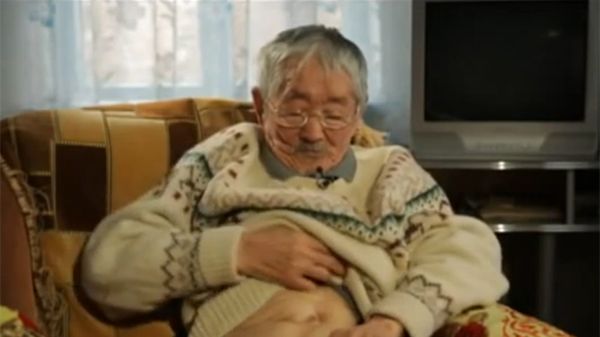 Esiteru Nakagawa pokazuje bliznę po nieudanym seppuku