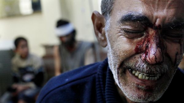 Ranny mężczyzna opłakuje śmierć swojej córki, Aleppo