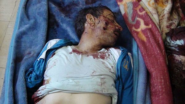 Mężczyzna zginął w ataku na obóz uchodźców