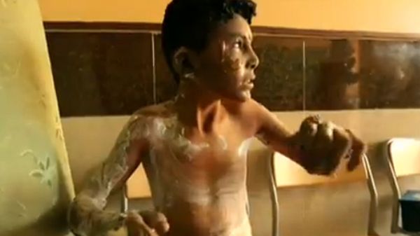 Jedno z poparzonych dzieci