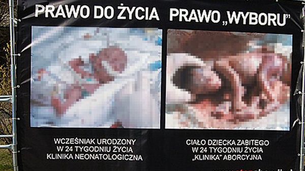 Część wystawy Fundacji PRO-Prawo do Życia