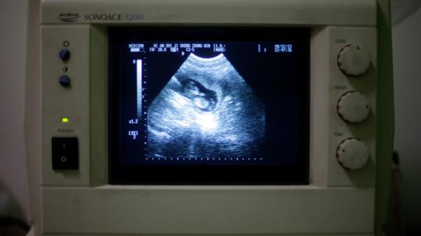 Obraz płodu w łonie matki