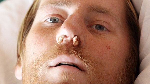 Mężczyzna znaleziony w szałasie w Tatrach